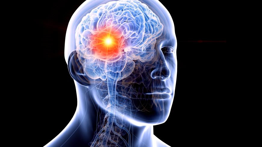 Metastasi cerebrali